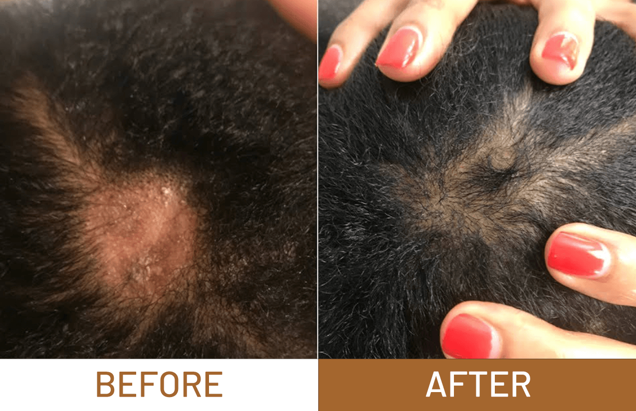 ¡PRODUCTO IMPORTADO! RESTAURADOR CAPILAR BATANA OIL
